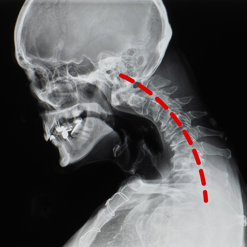 Chiropratico Roma - Chiropractic BioPhysics - Rigel & Rigel